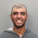 Illustration for article titled Half-Headed Man Takes World's Most Bizarre Mugshot